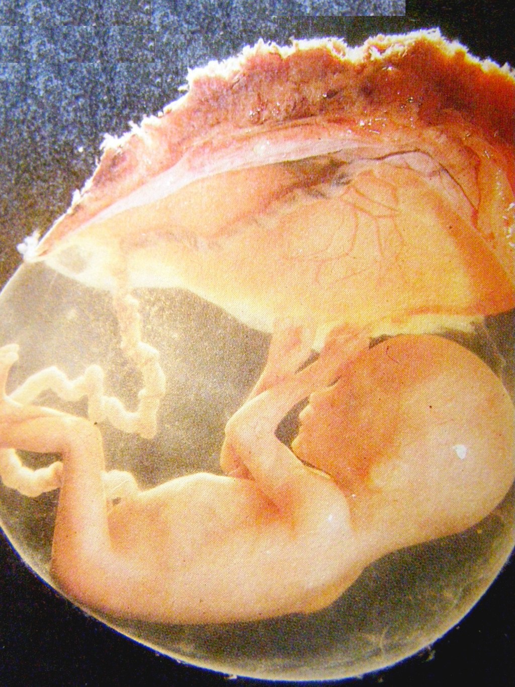 GPA et Éthique : Un Débat à&nbsp;l&rsquo;Écran