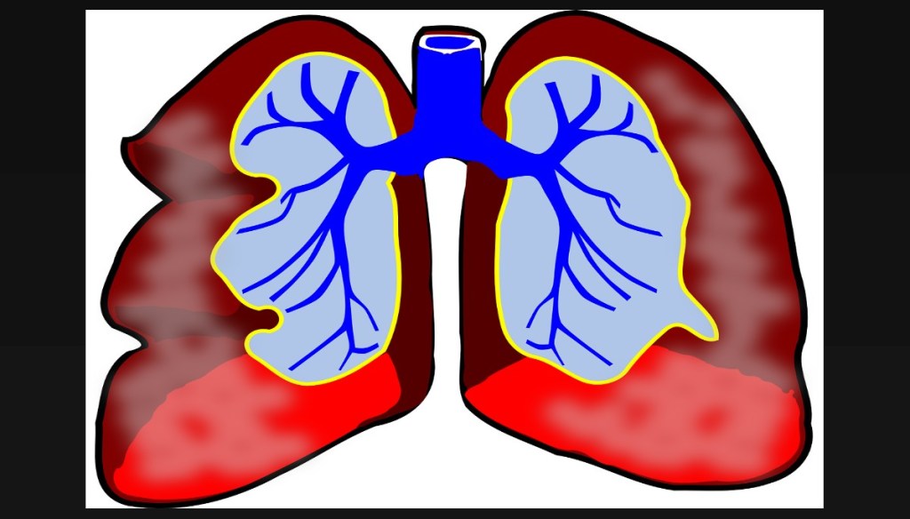 Asthme respiratoire, le sevrage du&nbsp;tabac