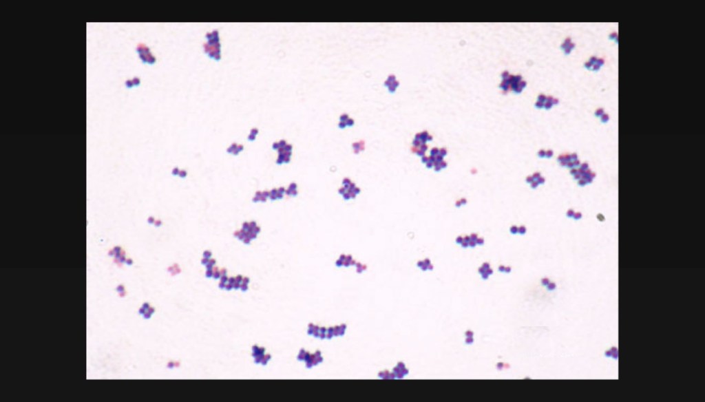 Le staphylocoque doré